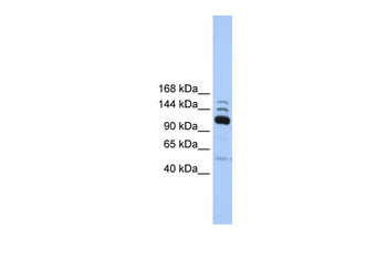 POLR3B Rabbit Polyclonal Antibody