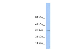 ECHDC1 Rabbit Polyclonal Antibody