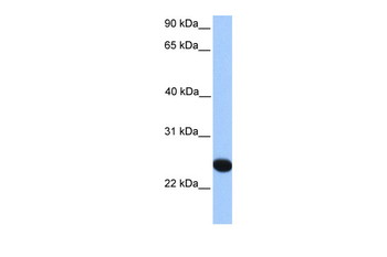 CSGlcA-T Rabbit Polyclonal Antibody
