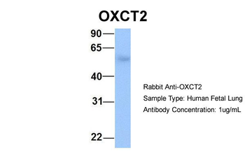 OXCT2 Rabbit Polyclonal Antibody