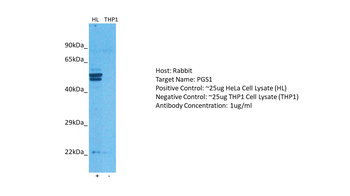 PGS1 Rabbit Polyclonal Antibody