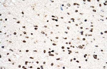 PGS1 Rabbit Polyclonal Antibody
