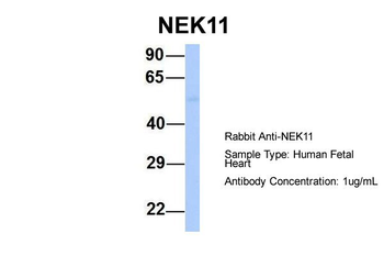 NEK11 Rabbit Polyclonal Antibody