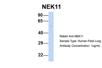 NEK11 Rabbit Polyclonal Antibody