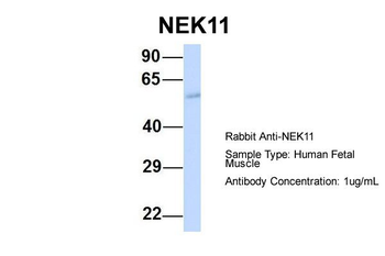NEK11 Rabbit Polyclonal Antibody