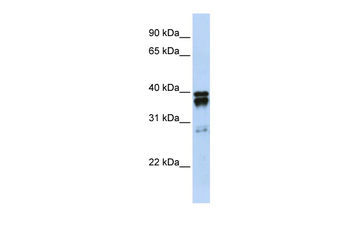 NUDT18 Rabbit Polyclonal Antibody