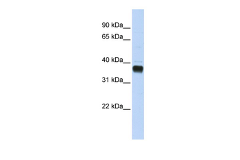 NUDT18 Rabbit Polyclonal Antibody