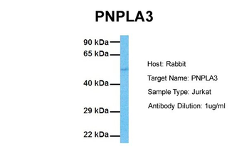 PNPLA3 Rabbit Polyclonal Antibody