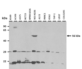 THUMPD2 Rabbit Polyclonal Antibody
