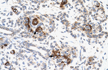 MAP2K2 Rabbit Polyclonal Antibody
