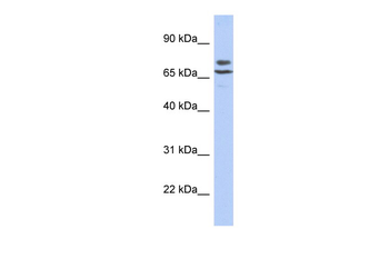 POMGNT2 Rabbit Polyclonal Antibody