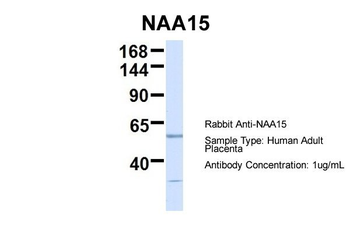 NARG1 Rabbit Polyclonal Antibody