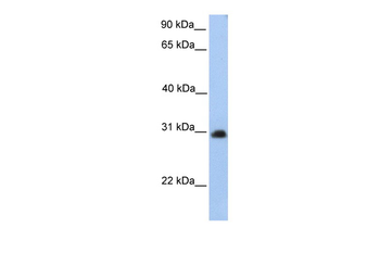 CHST14 Rabbit Polyclonal Antibody