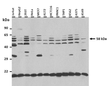 GPT2 Rabbit Polyclonal Antibody