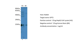 GPT2 Rabbit Polyclonal Antibody