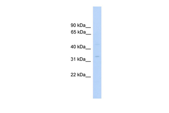 MTFMT Rabbit Polyclonal Antibody