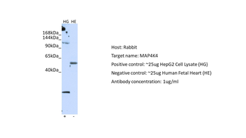 MAP4K4 Rabbit Polyclonal Antibody