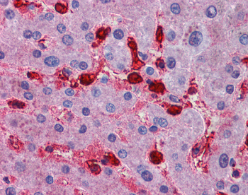 MAP4K4 Rabbit Polyclonal Antibody