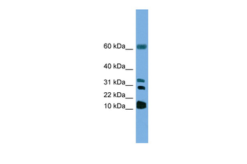 LTC4S Rabbit Polyclonal Antibody