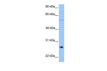 METTL7B Rabbit Polyclonal Antibody
