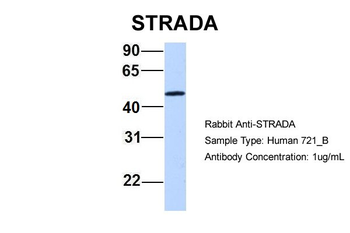 STRADA Rabbit Polyclonal Antibody
