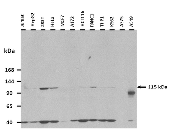 B4GALNT3 Rabbit Polyclonal Antibody