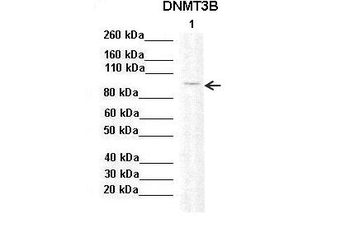 DNMT3B Rabbit Polyclonal Antibody