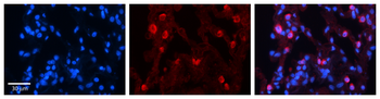 SULT1A1 Rabbit Polyclonal Antibody