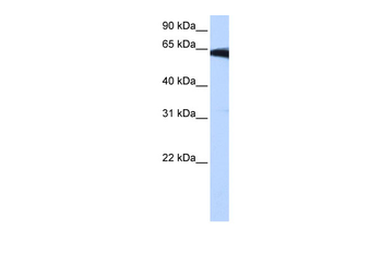 PIGW Rabbit Polyclonal Antibody