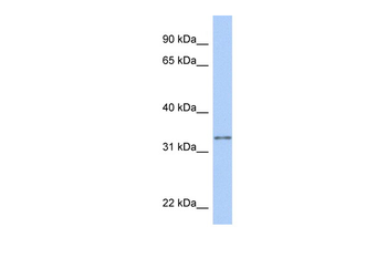 GSTO2 Rabbit Polyclonal Antibody