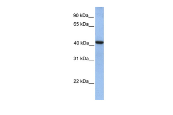 GMPPA Rabbit Polyclonal Antibody
