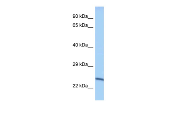 EEF1AKMT2 Rabbit Polyclonal Antibody