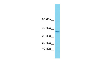 ALG1 Rabbit Polyclonal Antibody