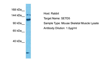 Setd5 Rabbit Polyclonal Antibody