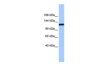 TEX2 Rabbit Polyclonal Antibody