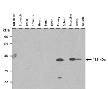 Tmem165 Rabbit Polyclonal Antibody