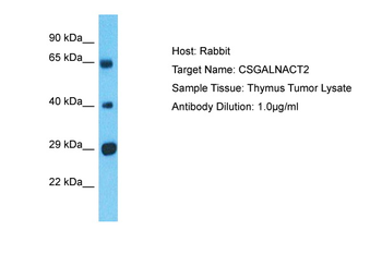 CSGALNACT2 Rabbit Polyclonal Antibody