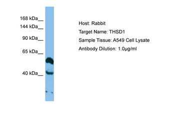 THSD1 Rabbit Polyclonal Antibody