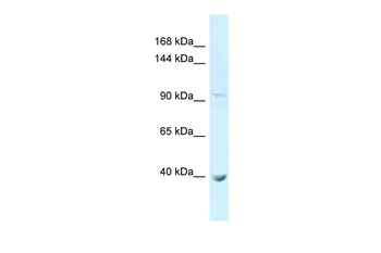 PCDHA11 Rabbit Polyclonal Antibody