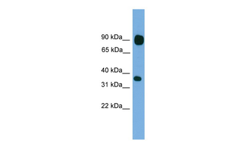 PCDHB15 Rabbit Polyclonal Antibody