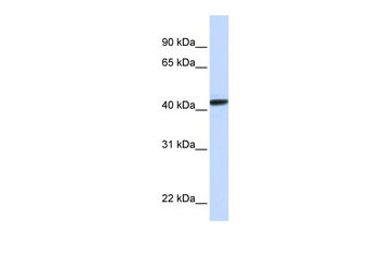 CLN8 Rabbit Polyclonal Antibody