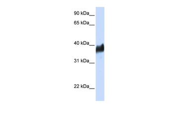 CLN8 Rabbit Polyclonal Antibody