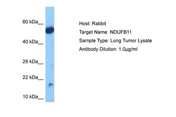 NDUFB11 Rabbit Polyclonal Antibody