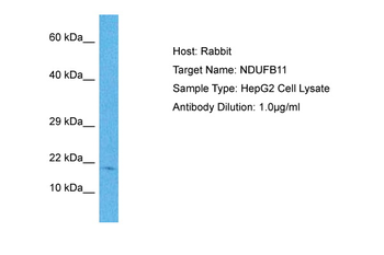 NDUFB11 Rabbit Polyclonal Antibody