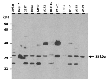 CRLS1 Rabbit Polyclonal Antibody