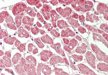 CRLS1 Rabbit Polyclonal Antibody
