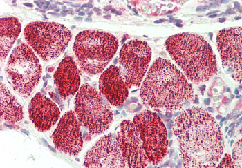 CRLS1 Rabbit Polyclonal Antibody