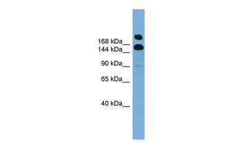 UGCGL1 Rabbit Polyclonal Antibody