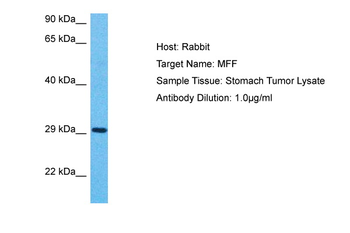 MFF Rabbit Polyclonal Antibody