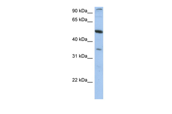 PLXDC1 Rabbit Polyclonal Antibody